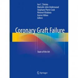 Coronary Graft Failure 1st/2016